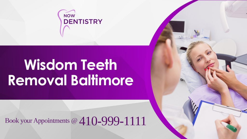 Wisdom Teeth Removal In Baltimore Now Dentistry Dentist Open Sunday Blog